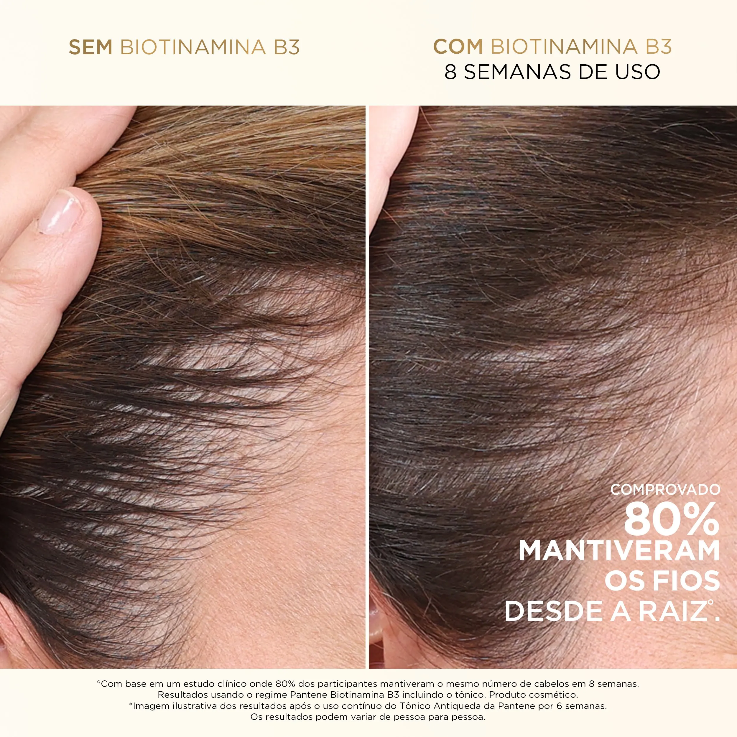 Condicionador Pantene Pro-V Miracles Biotinamina B3 Antiquebra & Nutrição 150ml — foto 3