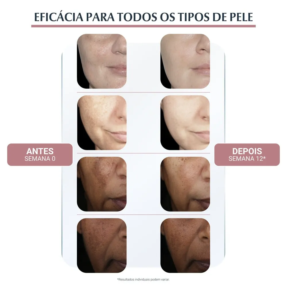 Creme Facial Eucerin Anti-Pigment Dia FPS 30 50ml — foto 5