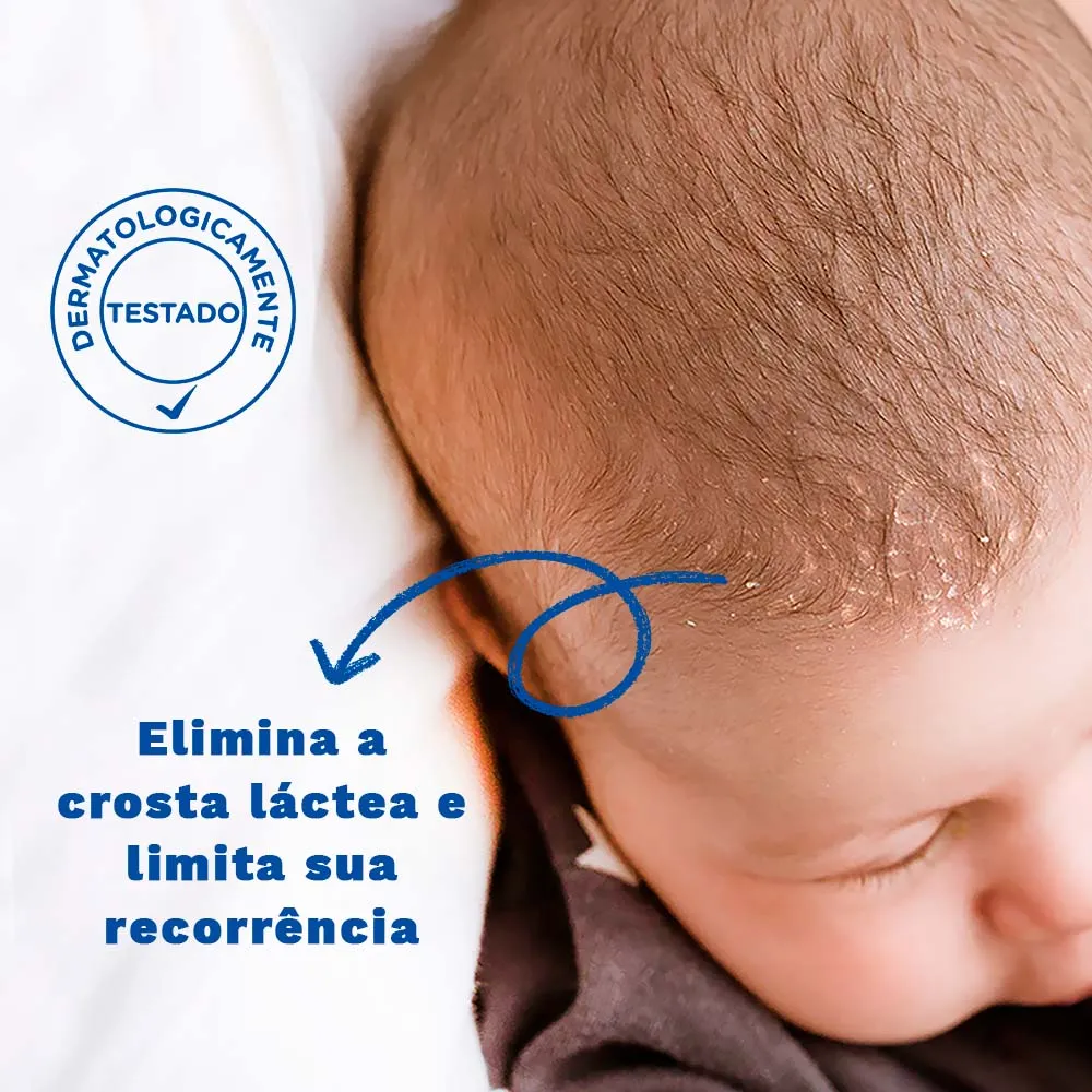 Creme para Crosta Láctea Mustela Stelaker Bebê Hipoalergênico 40ml — foto 3