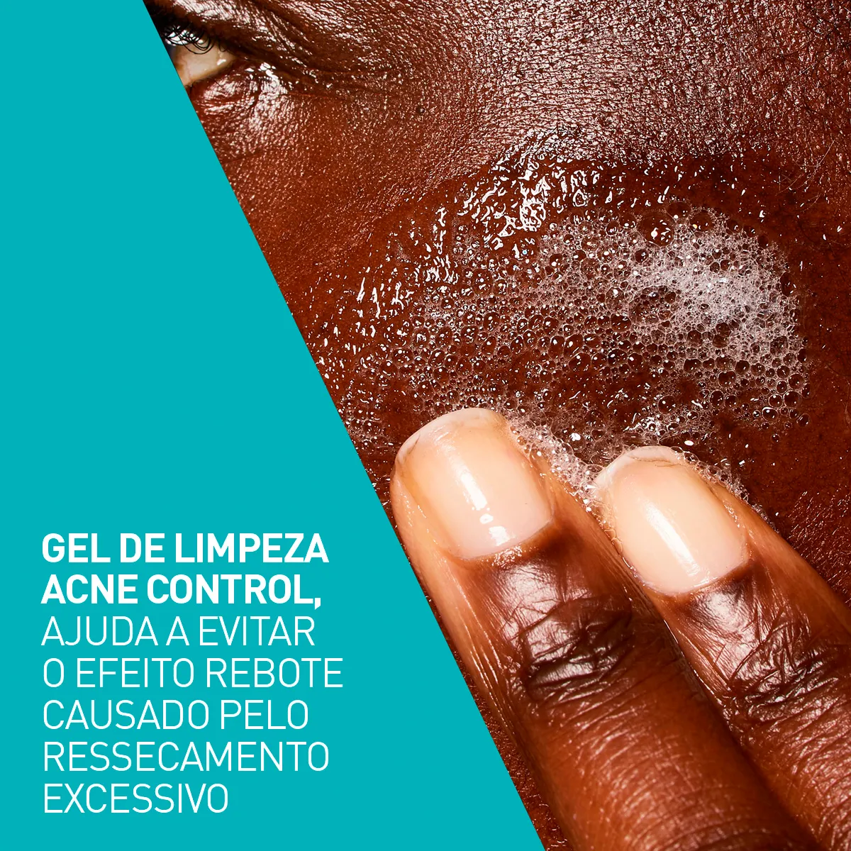 Gel de Limpeza Facial CeraVe Acne Control 227g — foto 8
