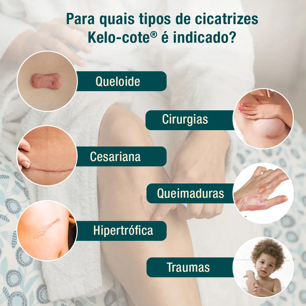 Gel para Cicatrizes Kelo-Cote de Silicone 100% 15g — foto 5