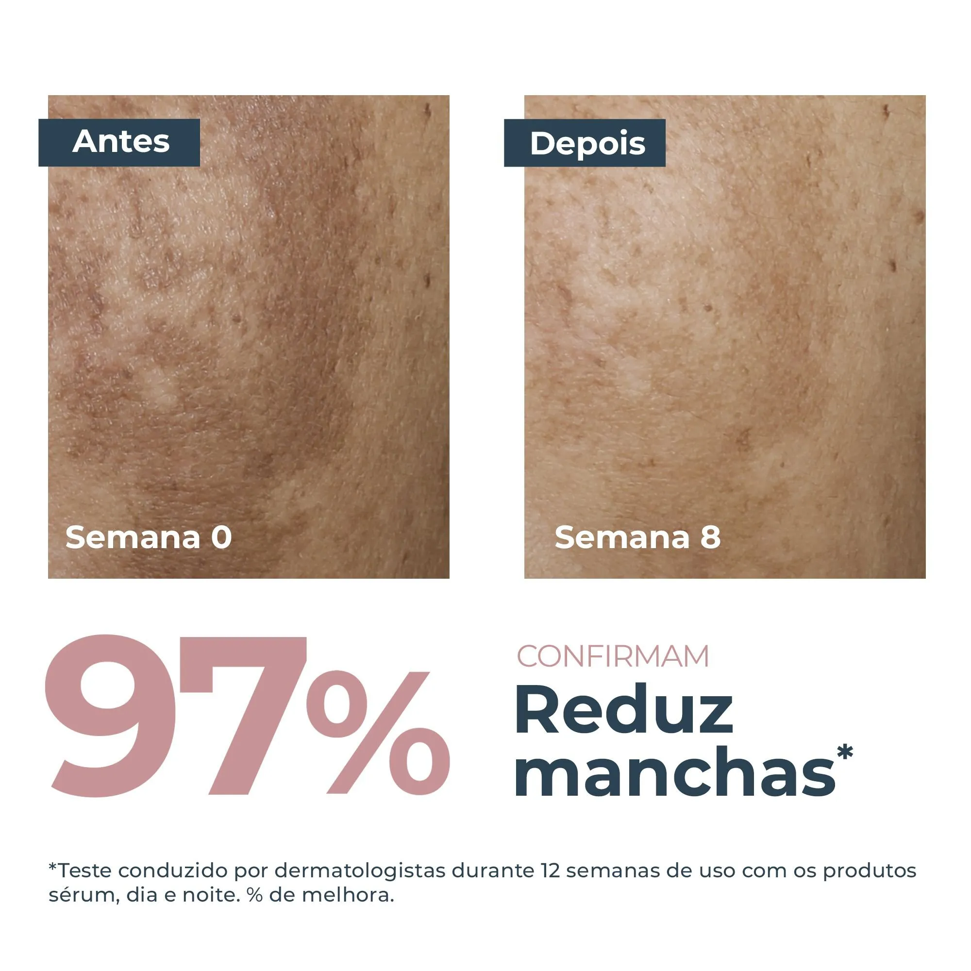 Sérum Facial Eucerin Anti-Pigment Clareador Dual 30ml — foto 3