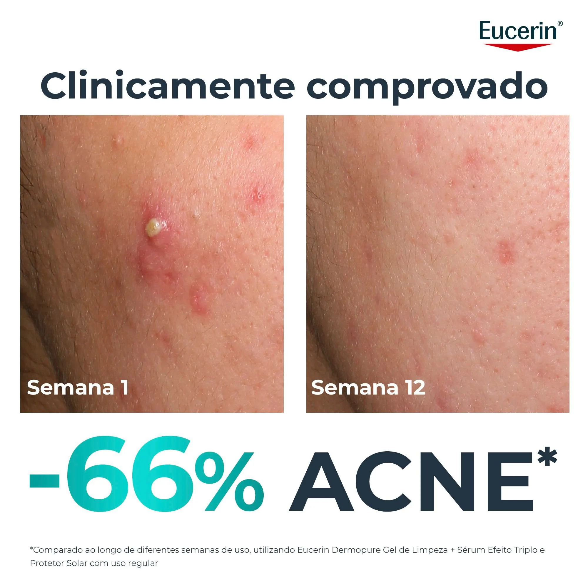 Sérum Facial Eucerin DermoPure Oil Control Efeito Triplo 40ml — foto 4