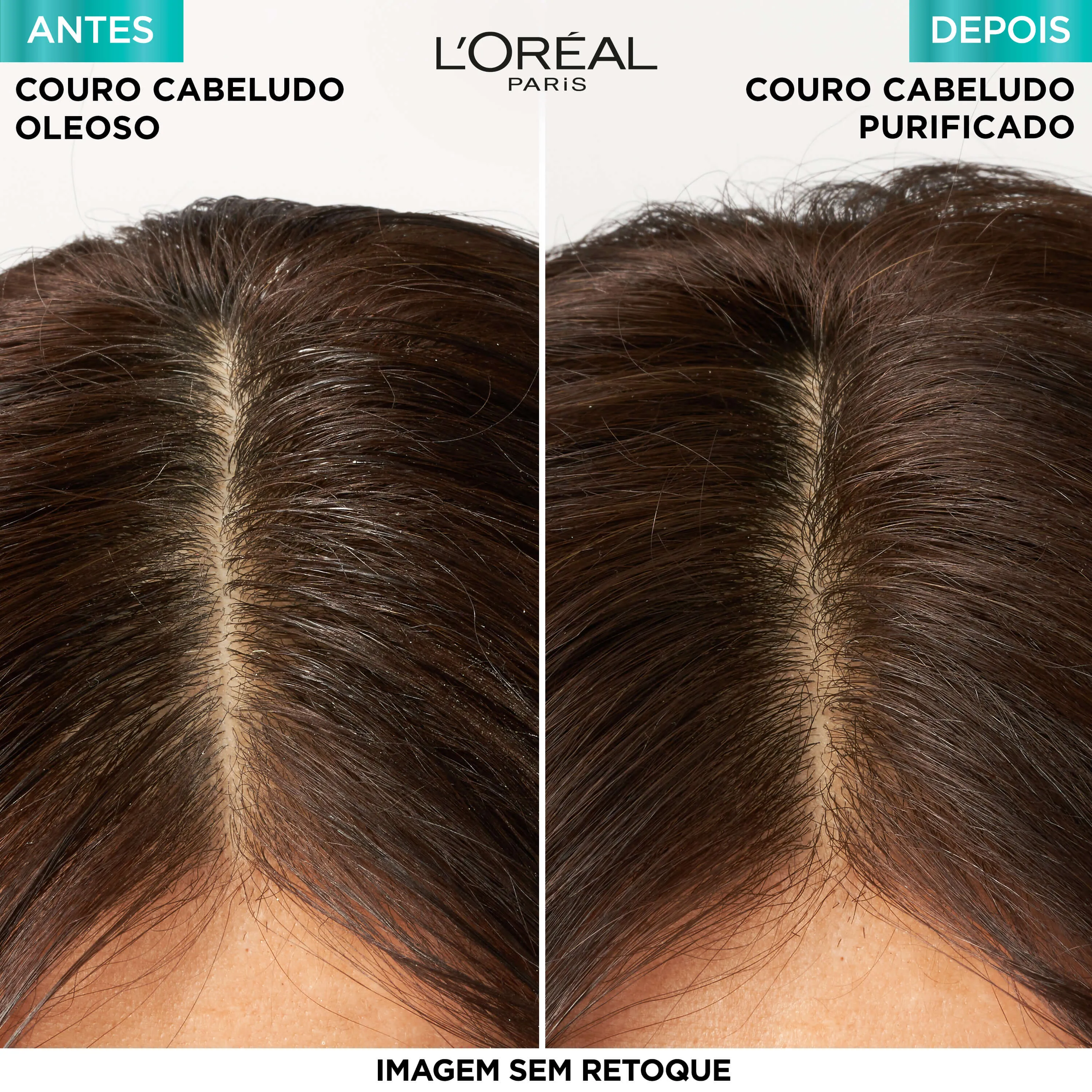 Shampoo Elseve Pure Hialurônico Hidra Purificante 400ml — foto 5